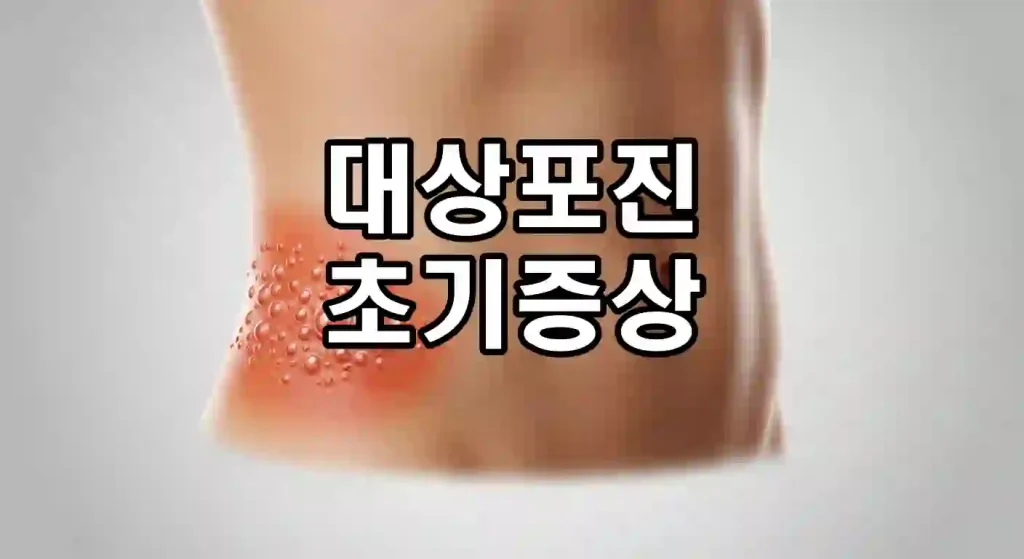 early symptoms of shingles