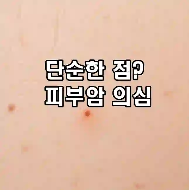 early symptoms of skin cancer